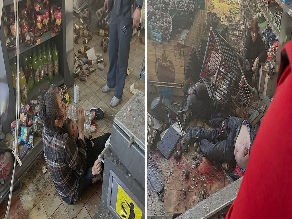 The dead and injured from the missile attack on the store. Russia continues to fight civilians