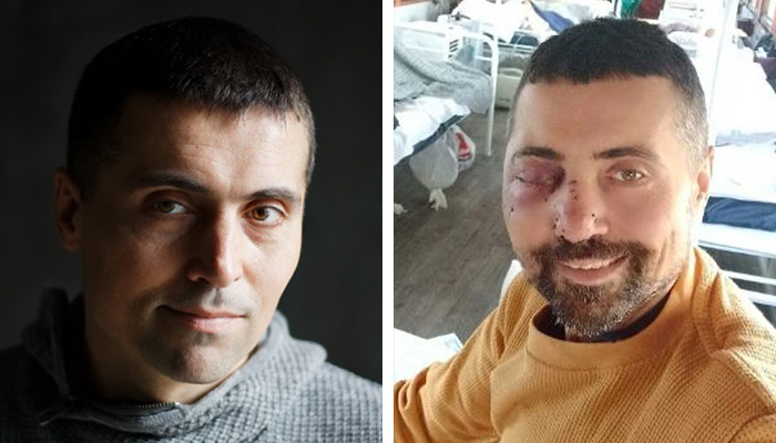 Ukraine 11 Janvier, 2023